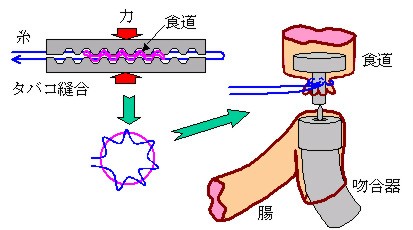 縫合 タバコ