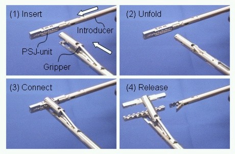 Assemblable Pursestring Suture Instrument for Laparoscopic Surgery